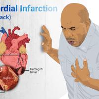 Heart attack wikimedia image