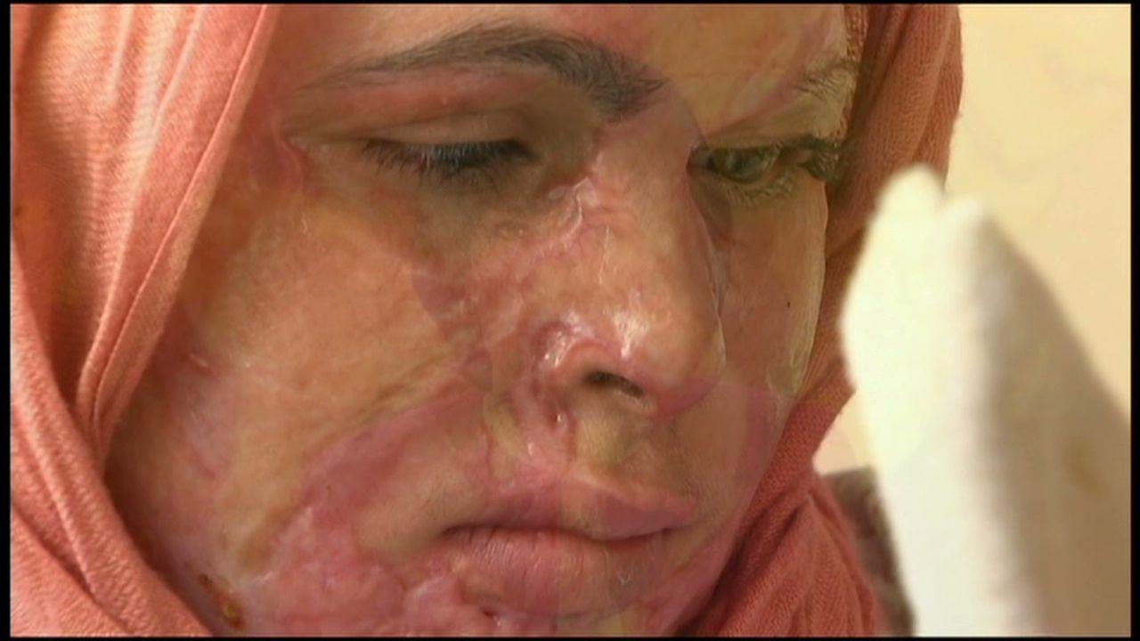 Afghani woman tortured screen capture